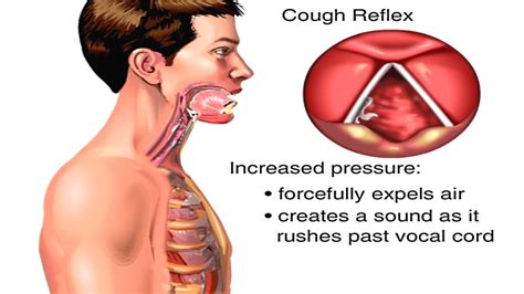 Diagram Of A Cough