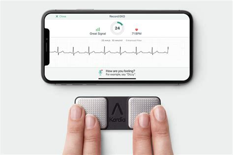 AliveCor KardiaMobile kan met ECG drie hartafwijkingen meten