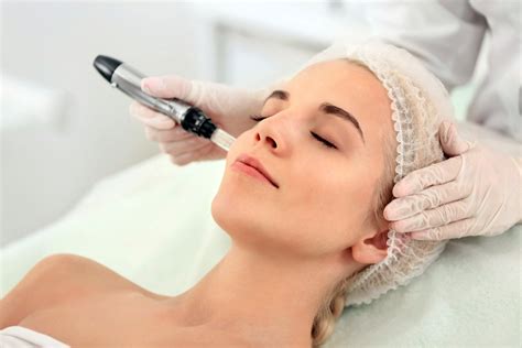 Micro Needling - La Vie en Rainey