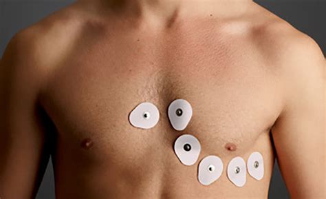 Selecting the Optimal Adhesive for Wearable Medical Devices | 2018-05-01 | ASI Magazine ...