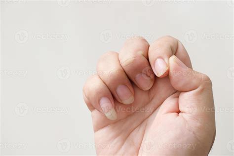 Problems with long, dirty fingernails and bacterial germs 21850883 Stock Photo at Vecteezy