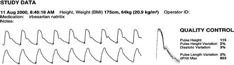 Pulse Wave Analysis | IntechOpen