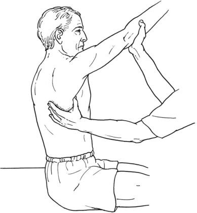 Testing the Muscles of the Upper Extremity | Musculoskeletal Key