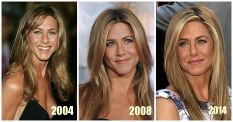 Jennifer Aniston's Plastic Surgery Journey - Vanity