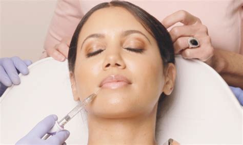 Dermal Filler Injections: Everything You Need to Know - Dr Nerina Wilkinson + Associates