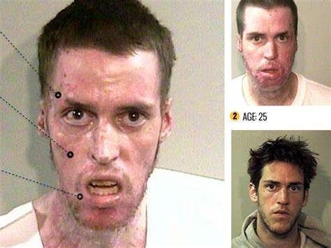 Meth Before And After Pics 2020