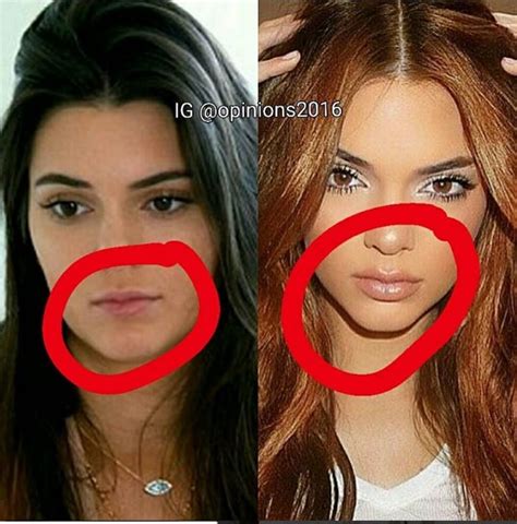 Kendall Jenner Before and After Archives - GhanaCelebrities.Com