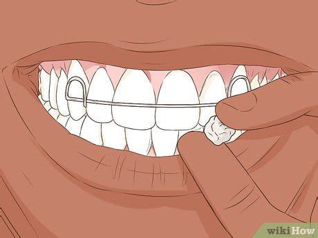 How to Heal a Bitten Tongue: First Aid & Treatment