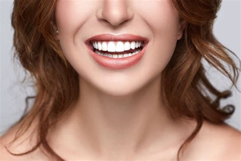 What Are the Pros and Cons of Porcelain Veneers? - Atlanta Smiles
