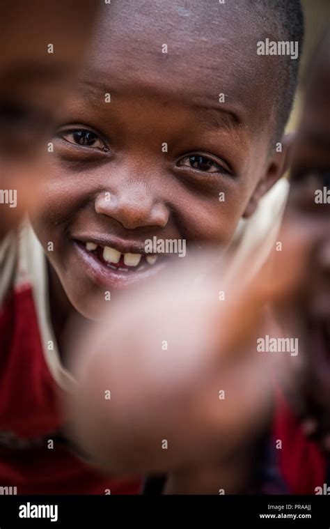 Africa health poverty malnutrition hi-res stock photography and images - Alamy