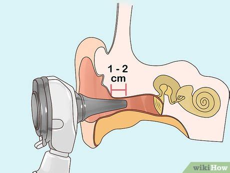 How to Use an Otoscope: 13 Steps (with Pictures) - wikiHow