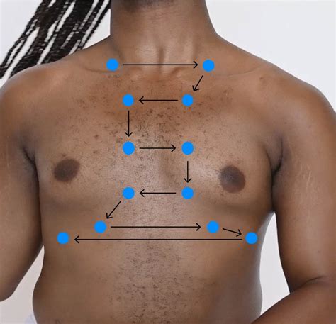 Anterior Thorax – Auscultation – Introduction to Health Assessment for ...