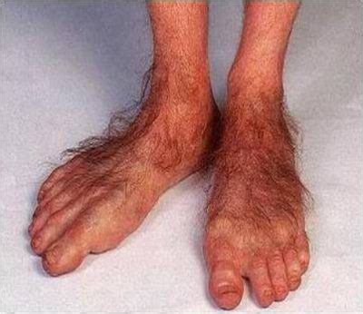 Do You Have Ugly Feet? | Goody Foot