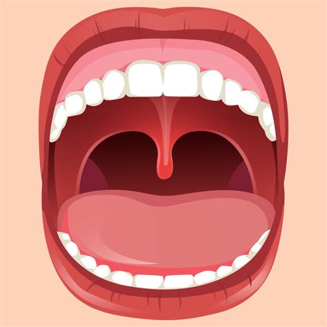 Uvula White After Surgery