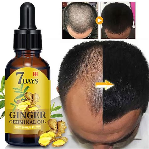 Upgraded 7 Days Ginger Germinal Oil Hair Regrowth Serum Hairdressing ...