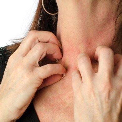 24 Photos That Show What Fibromyalgia Symptoms Look Like | Rash on neck ...