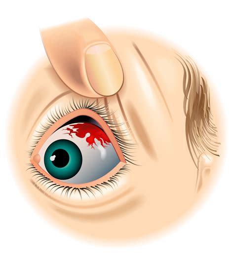 7 Causes of a Red Spot on Your Eye (And How to Treat Them)