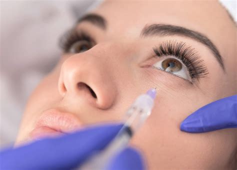 Jelly Roll Botox: What It Is & Why It's Trending | RealSelf News