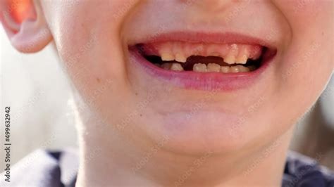 toothless smile of a child Stock Video | Adobe Stock