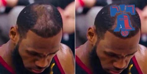 Lebron James Has A New Hairline :: Hip-Hop Lately