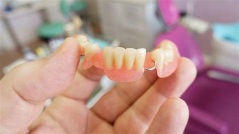 What Is A Partial Denture – Forbes Health