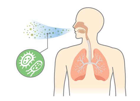 What is pneumonia? | LSTM