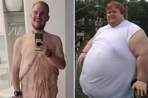 Estrella de reality shows pierde 270 kg y transforma su vida - Explicat