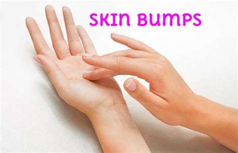 Skin Bumps Write For Us, Guest Post, and Submit Post