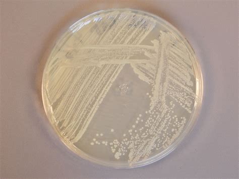 Citrobacter freundii | Classroom Bacterial Identification Wiki | Fandom