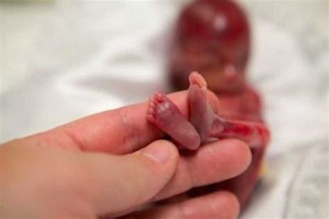 Stillborn Baby Changes Families Life Forever. Photos Will Amaze You.