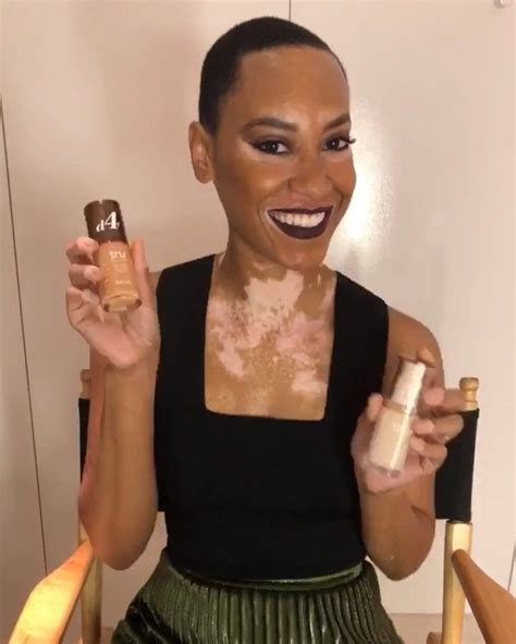 CoverGirl’s Latest Foundation Campaign Celebrates A Model With Vitiligo Vitiligo Model ...