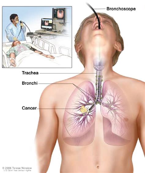 Chapter 2 Review on Image Guided Lung Biopsy | Semantic Scholar