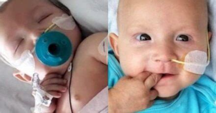 Μωράκι 4 μηνών με όγκο στην κοιλιά σώθηκε μετά από χειρουργείο που κράτησε περίπου 7 ώρες - Fanpage