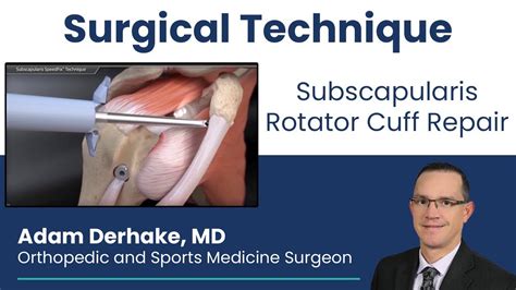 Subscapularis Rotator Cuff Repair: Surgical Technique - YouTube