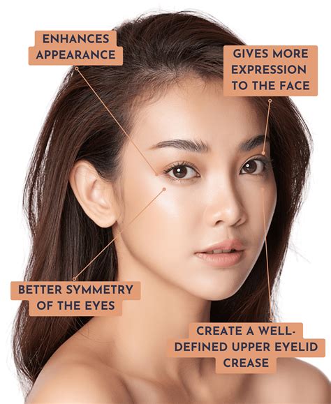 Double Eyelid Surgery/Epicanthoplasty Singapore - Allure Plastic Surgery