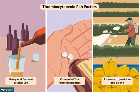 Thrombocytopenia: Causes and Risk Factors