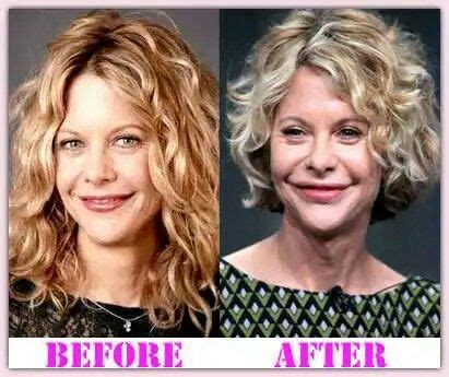 Meg Ryan before and after her plastic surgery. | Bad plastic surgeries, Celebrity plastic ...