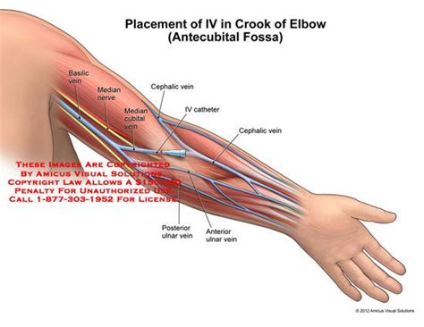 a diagram of the arm and wrist muscles