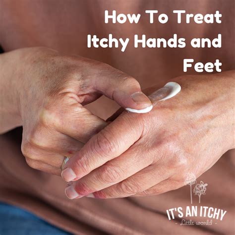 How To Treat Itchy Hands and Feet