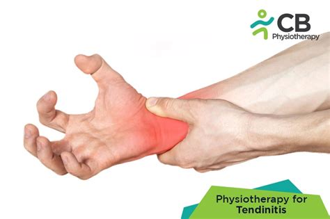 Tendinitis Treatment Doctors in Hyderabad| Book Appointment / Consult ...