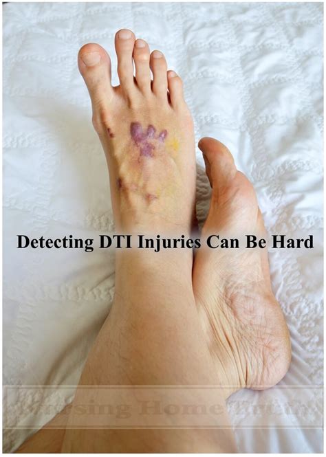 DTI Wound - Suspected Deep Tissue Injury **(2023)**