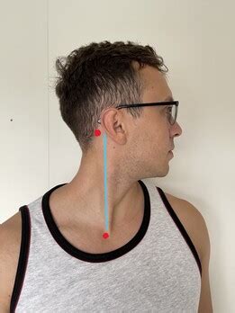 Best Sternocleidomastoid Stretches