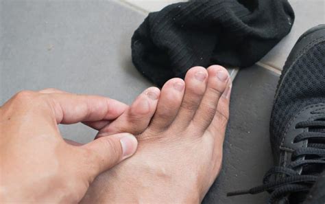 Runner's Feet: The 5 Most Common Injuries, And Foot Care For Runners