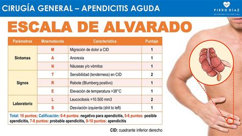 APENDICITIS AGUDA (Score de Alvarado) - pierodiaz med | Apendicitis ...