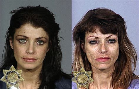 The Blog of a Bounder, Cad & Scoundrel: Drug Addict Photos: Before and After!!