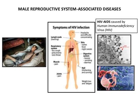 Male Reproductive System - Anatomy, Physiology and Pathology