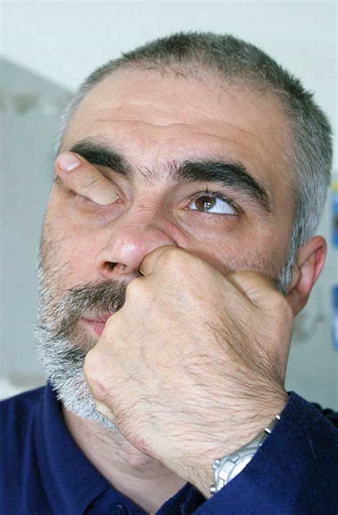 Man sticks a finger in his nose through his eye socket - Weird Picture Archive