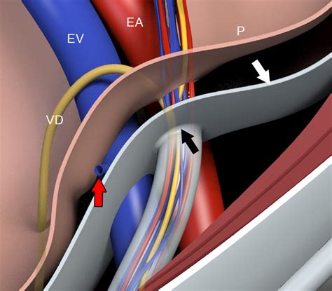 Inguinal Canal Diagram