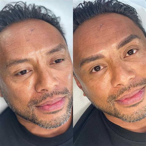 Microblading for Men: Why Do Guys Opt for Microblading?