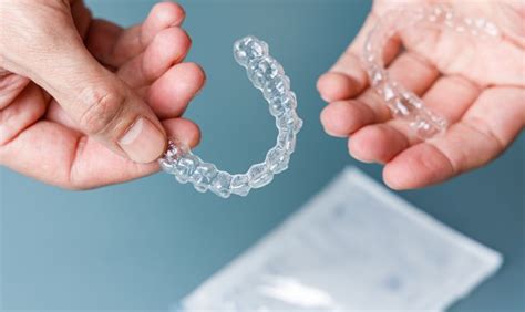 Smile Transformation: Can Invisalign Correct Overcrowded Teeth?